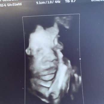 Next Generation Prenatal Imaging - Ultrasound Imaging Centers Near Me - Elk Grove, California Next Generation Prenatal Imaging - Ultrasound Imaging Centers Near Me - Elk Grove, California