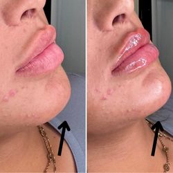 Envy Injectables & Skincare