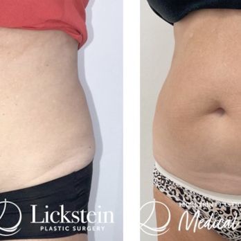 Selah Aesthetics - Before & After - Cosmetic Surgeons Near Me - Palm Beach Gardens, Florida Selah Aesthetics - Before & After - Cosmetic Surgeons Near Me - Palm Beach Gardens, Florida