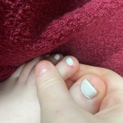 Perfect 10 Nails & Spas - A Cut covered by clear coat  OUCH!