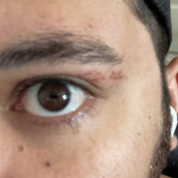 Linda's Hair Salon - Skin issue - Hair Salons Near Me - El Paso, Texas