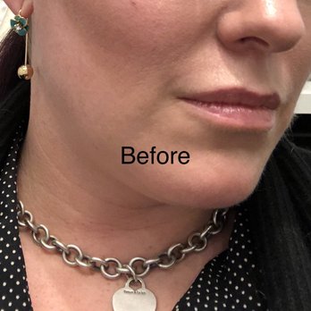 Refine Cosmetic Surgery - Medical Spas Near Me - Vancouver, British Columbia Refine Cosmetic Surgery - Medical Spas Near Me - Vancouver, British Columbia