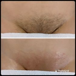 Aesthetics By Lily - Brazilian wax