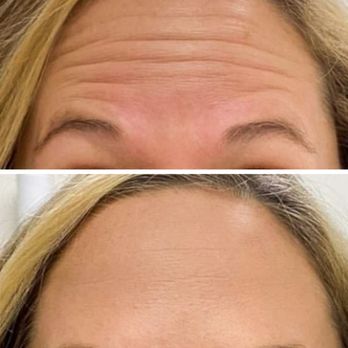 Superior Aesthetics - Marquette Botox - Medical Spas Near Me - Marquette, Michigan Superior Aesthetics - Marquette Botox - Medical Spas Near Me - Marquette, Michigan