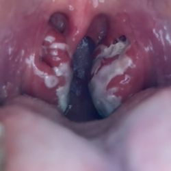 OhioHealth Ear Nose & Throat Physicians