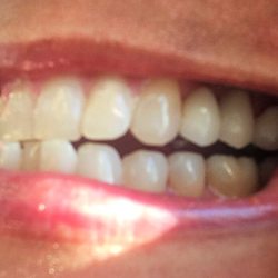 Yolanda S Cervantes, DMD - I can Smile again