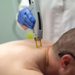 Mineapolis Anti-Aging & Skin Clinic - Laser Hair Removal for Men & Women