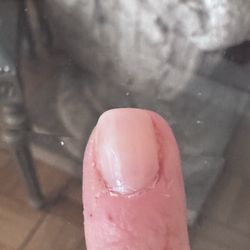 Uneven nail messy cuticles