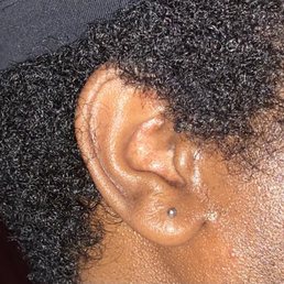 Earlobe piercing (right side) Earlobe piercing (right side)