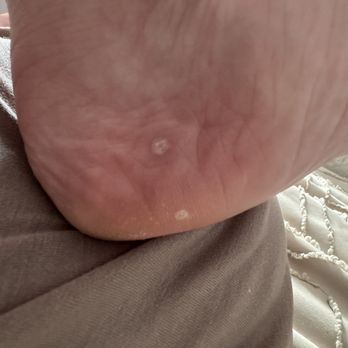 Queen Spa - So they charge $5 to use the foot file that looks like a greater and my feet look like this - Nail Salons Near Me - Weymouth, Massachusetts