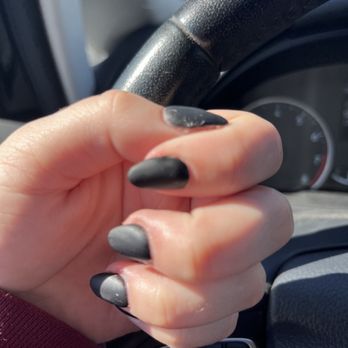 Expert Nails & Spa - This was my thumb the next day - Nail Salons Near Me - Louisville, Kentucky Expert Nails & Spa - This was my thumb the next day - Nail Salons Near Me - Louisville, Kentucky