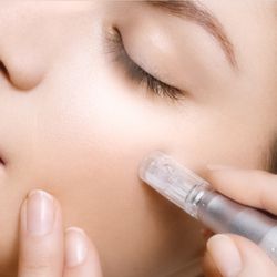 The Wild Beauty Bar - Microneedling!