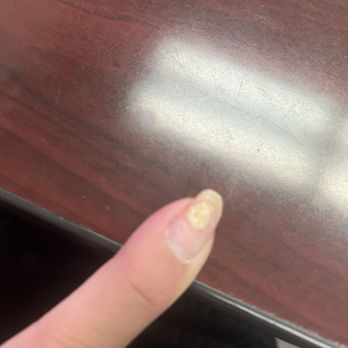 NT Nail Spa - Damaged nail - Nail Salons Near Me - Modesto, California NT Nail Spa - Damaged nail - Nail Salons Near Me - Modesto, California