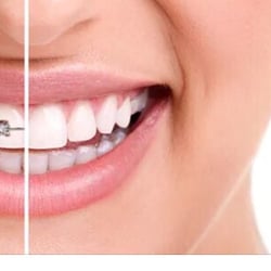 Advanced Dental Associates of East Stroudsburg