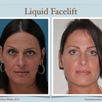 W. Matthew White, M.D - Cosmetic Surgeons Near Me - New York, New York W. Matthew White, M.D - Cosmetic Surgeons Near Me - New York, New York