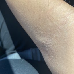 Swollen after test
