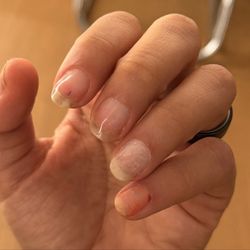 d-uñas
