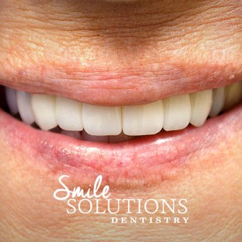 Smile Solutions Dentistry - Cosmetic Dentists Near Me - Harrisburg, North Carolina Smile Solutions Dentistry - Cosmetic Dentists Near Me - Harrisburg, North Carolina
