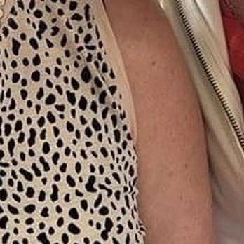 Forever Beauty - Before earlier that day, my pasty paleness - Tattoo Removal Near Me - Antioch, California Forever Beauty - Before earlier that day, my pasty paleness - Tattoo Removal Near Me - Antioch, California