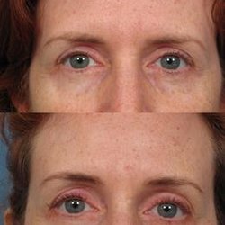 Facial Plastic Surgery Center - Before & After
Aesthetic & Spa Services