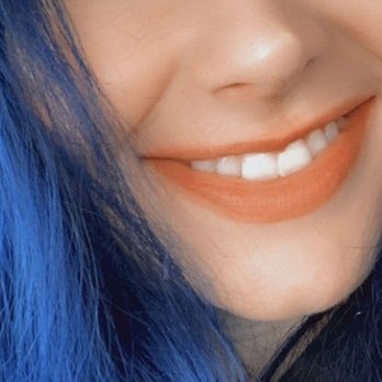 LaserAway - Before lip fillers - Laser Hair Removal Near Me - Huntington Beach, California