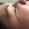 Precision Skin And Wellness gift card