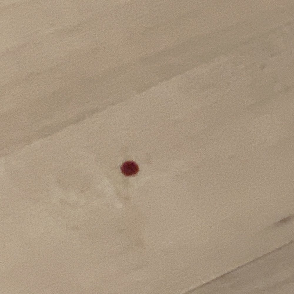 Total Access Urgent Care - Blood on floor of exam room - Urgent Care Near Me - Ellisville, Missouri Total Access Urgent Care - Blood on floor of exam room - Urgent Care Near Me - Ellisville, Missouri