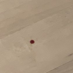 Total Access Urgent Care - Blood on floor of exam room