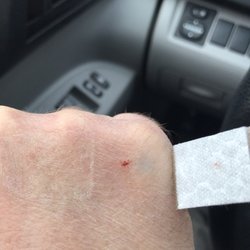 Alta Veterinary Hospital - Where the clinics cat bit me, 30 minutes later.