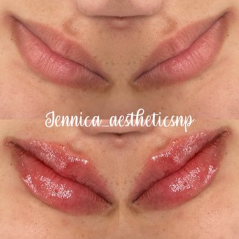 Aesthetically Rosa - Medical Spas Near Me - Fircrest, Washington