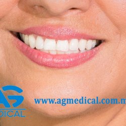 AG Medical - Diseño de sonrisa en León, Guanajuato. 

Dentista en León Gto