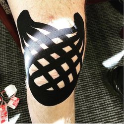 River Vale Physical Therapy - Kinesiology tape being used for edema/swelling after a Total Knee Replacement. All services also available at River Vale Phy...