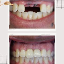 Jacob Elisha, DDS - Southern California Implant Centers