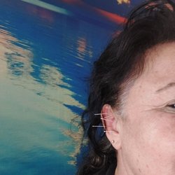 Integrative Medicine Coral Springs - Acupuncture to quit smoking