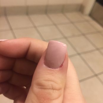 Ok Nail - The cut on just one of my many nails. - Nail Salons Near Me - Whittier, California