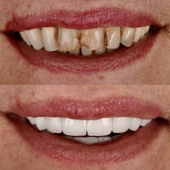 Dental Artistry - Cosmetic Dentists Near Me - Bend, Oregon