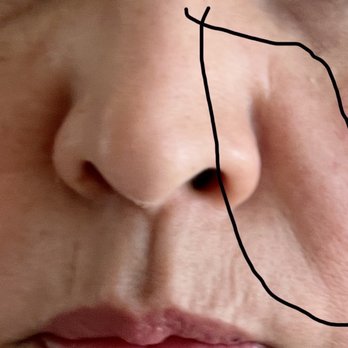 Sublime MD - Laser Hair Removal Near Me - Mission Viejo, California