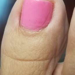 Please zoom in. This is the same day that the pedicure was done at Cobe nails. Please zoom in. This is the same day that the pedicure was done at Cobe nails.