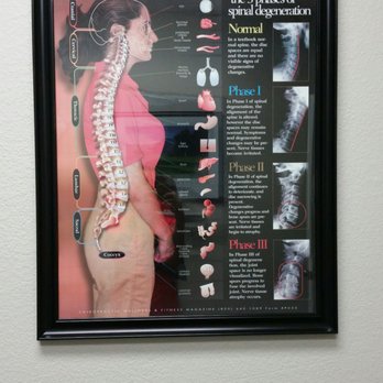 West Coast Chiropractic - Chiropractors Near Me - Temecula, California