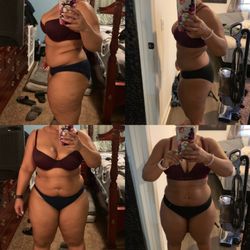 Back 2 Health Physical Medicine - Actual patient before and after pictures
