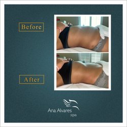 Ana Alvares Spa