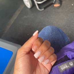 After 1 week After 1 week