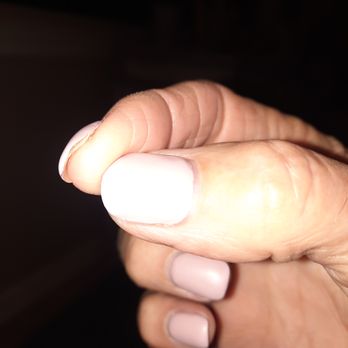 Prestige Nails - Structured gel is separating from natural nail after 1 1/2 weeks of a fresh overlay. - Nail Salons Near Me - Escondido, California Prestige Nails - Structured gel is separating from natural nail after 1 1/2 weeks of a fresh overlay. - Nail Salons Near Me - Escondido, California