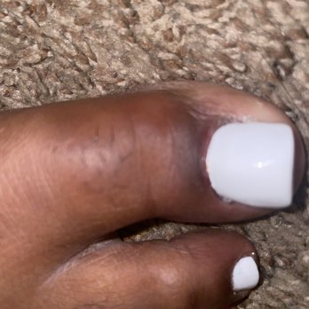 Fashion Nails & Spa - Bleeding as well - Nail Salons Near Me - Saint Charles, Missouri