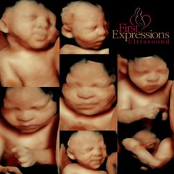 First Expressions Ultrasound