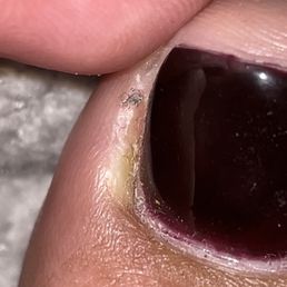 INFECTED TOE BECAUSE THEY FUCKED MY TOE UP. THEY ARE UNSANITARY AND UNSAFE. I REPORTED THEM TO THE DBPR.