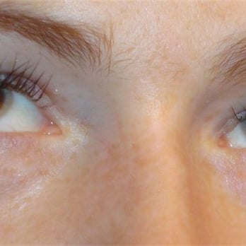 Cyan Silva Beauty Therapy - Health & Medical Near Me - Edinburgh, EDH Cyan Silva Beauty Therapy - Health & Medical Near Me - Edinburgh, EDH