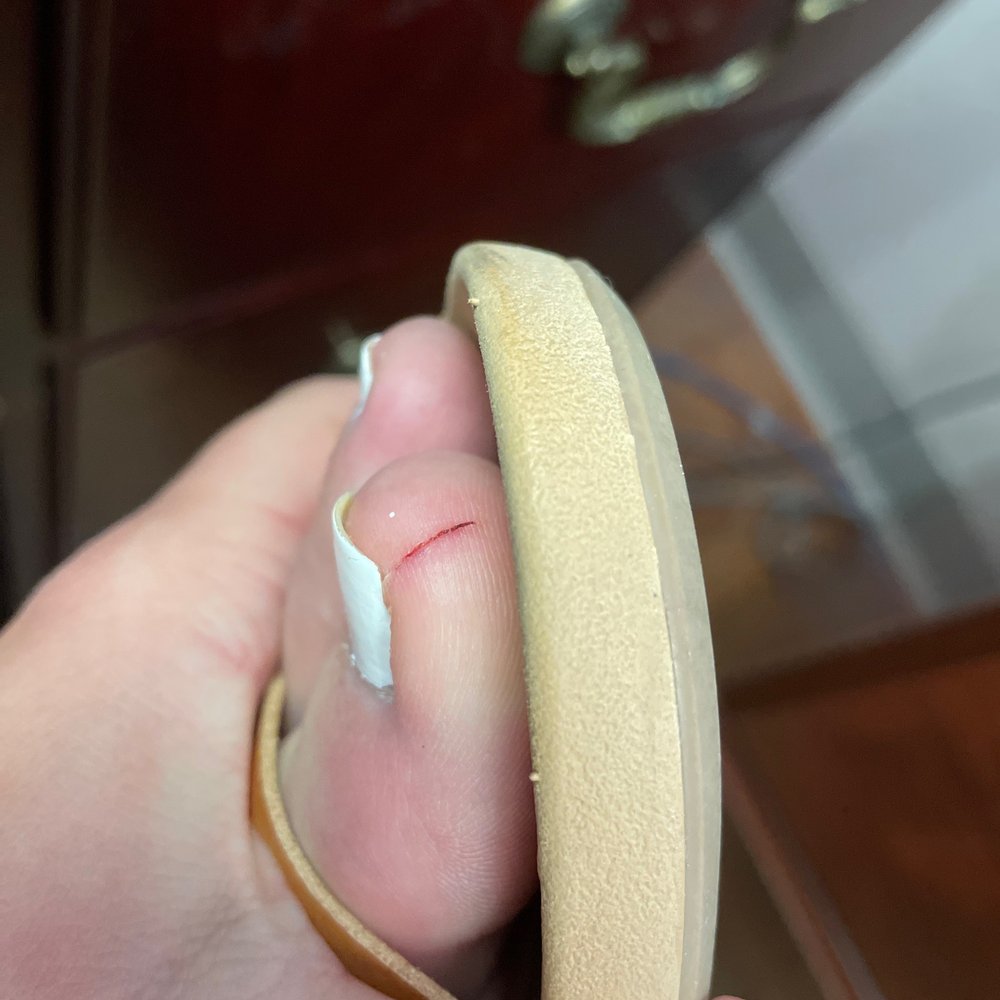 Lee Nails - Cut my toe and then tried to hide it. - Nail Salons Near Me - Clinton, South Carolina