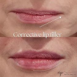 Anllo Center for Aesthetics