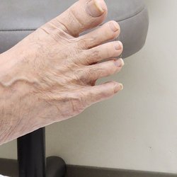 Sandra Au, DPM - Da foot